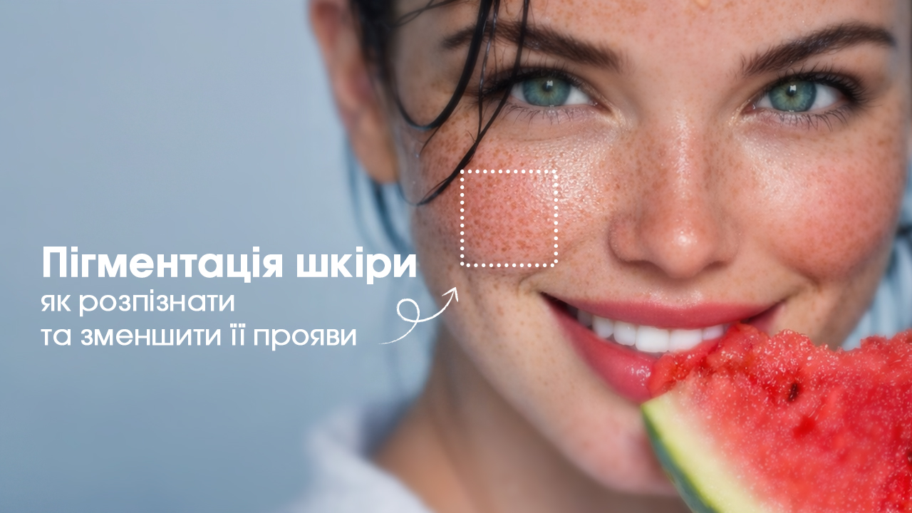 Як зменшити прояви пігментації?